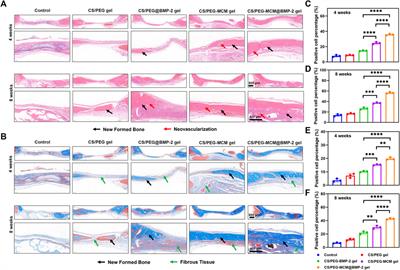 BMP-2 releasing mineral-coated microparticle-integrated hydrogel system for enhanced bone regeneration